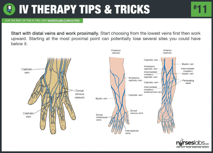 Skills module 3.0 iv therapy and peripheral access posttest