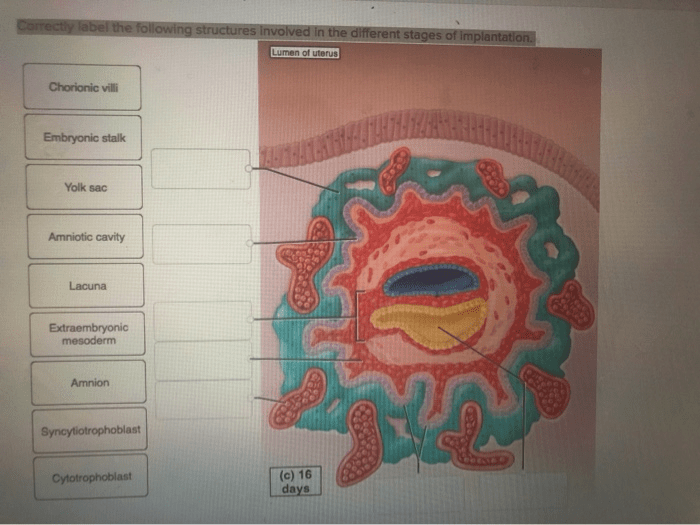 Correctly label the following structures of a nail.