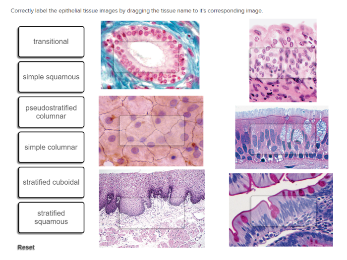 Nail diagram nails structures structure anatomy bed matrix edge plate slideshare choose board hyponychium upcoming conversion problems physiology shape chart